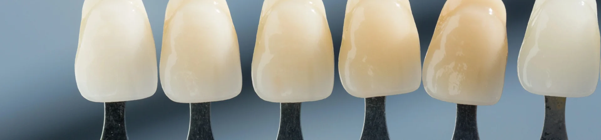 acnis restauration esthetique dentaire 03